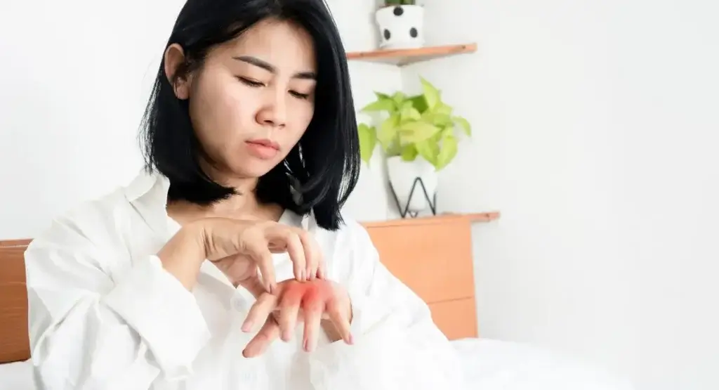 Picture of a woman scratching her hand while wondering what do bed bug bites look like.