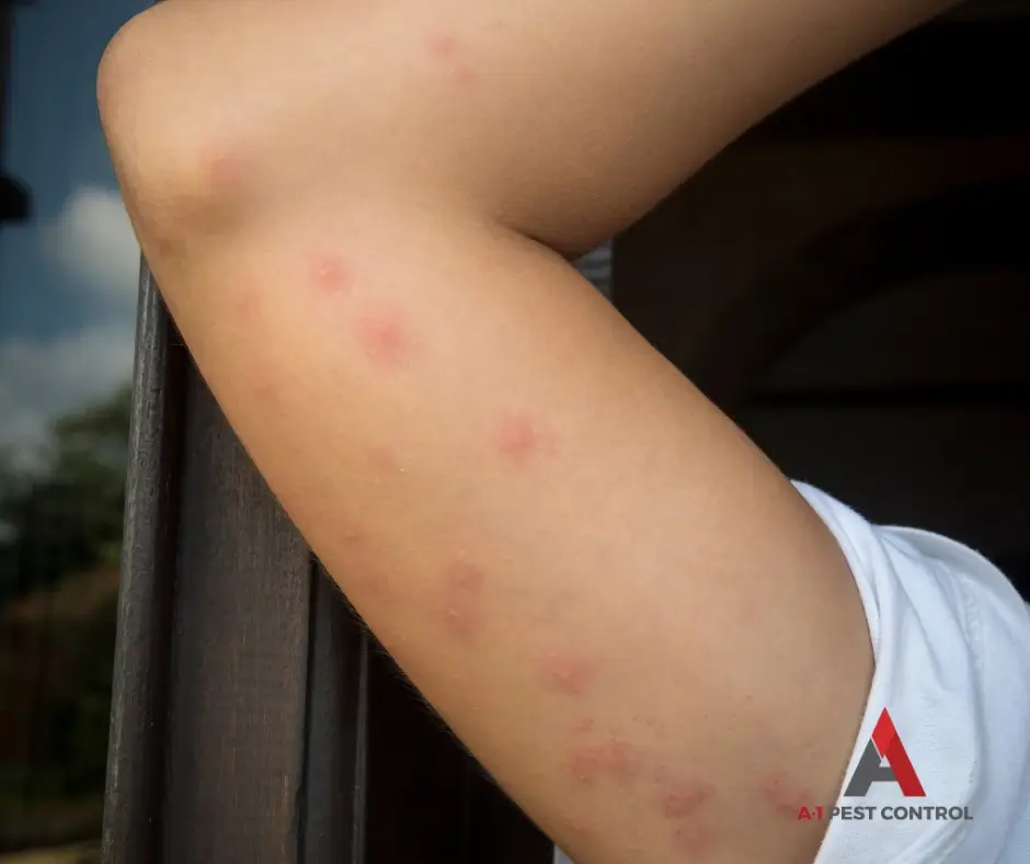 symptoms of a bed bug infestation